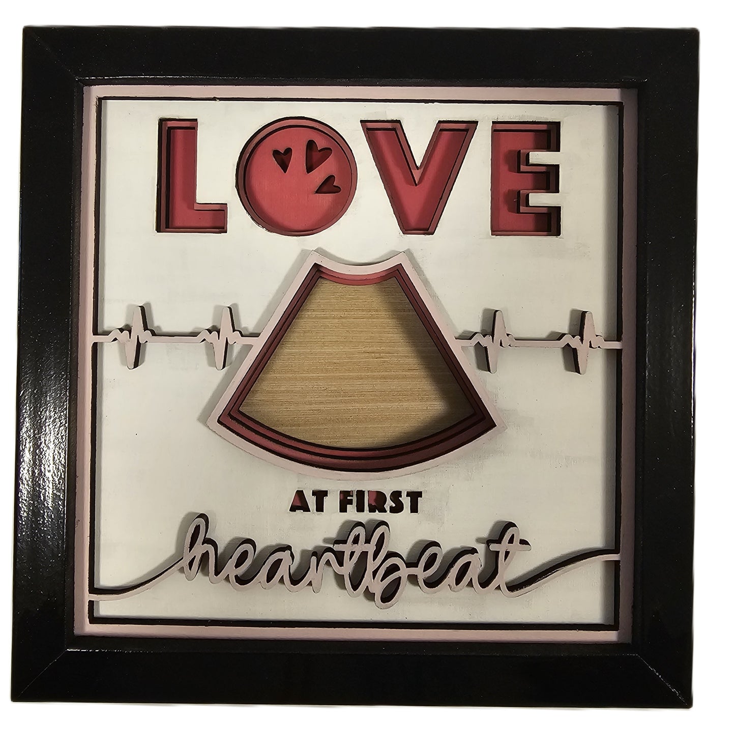 Love at First Heartbeat Ultrasound Frame